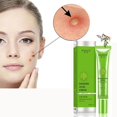 thumbnail image 3 of Crema facial para eliminar el acné, tratamiento para el acné, manchas de acné, Control de aceite, reducción de poros, blanqueamiento, crema hidratante para el acné, cuidado de la piel Feliz Sencillez, 3 of 5