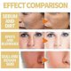 thumbnail image 4 of 3bottle Bright White Exfoliating Oil Deep Cleansing Exfoliating Dead Skin Car, 4 of 5