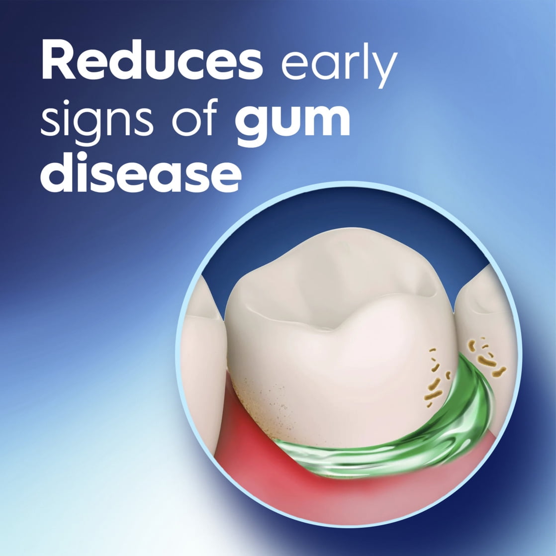 Crest Pro-Health Gum Restore Mouthwash/Mouth Rinse, Antigingivitis/Antiplaque, Clinically Proven, Fights Gum Disease, Alcohol Free, Smooth Mint - 1L (33.8 fl oz)