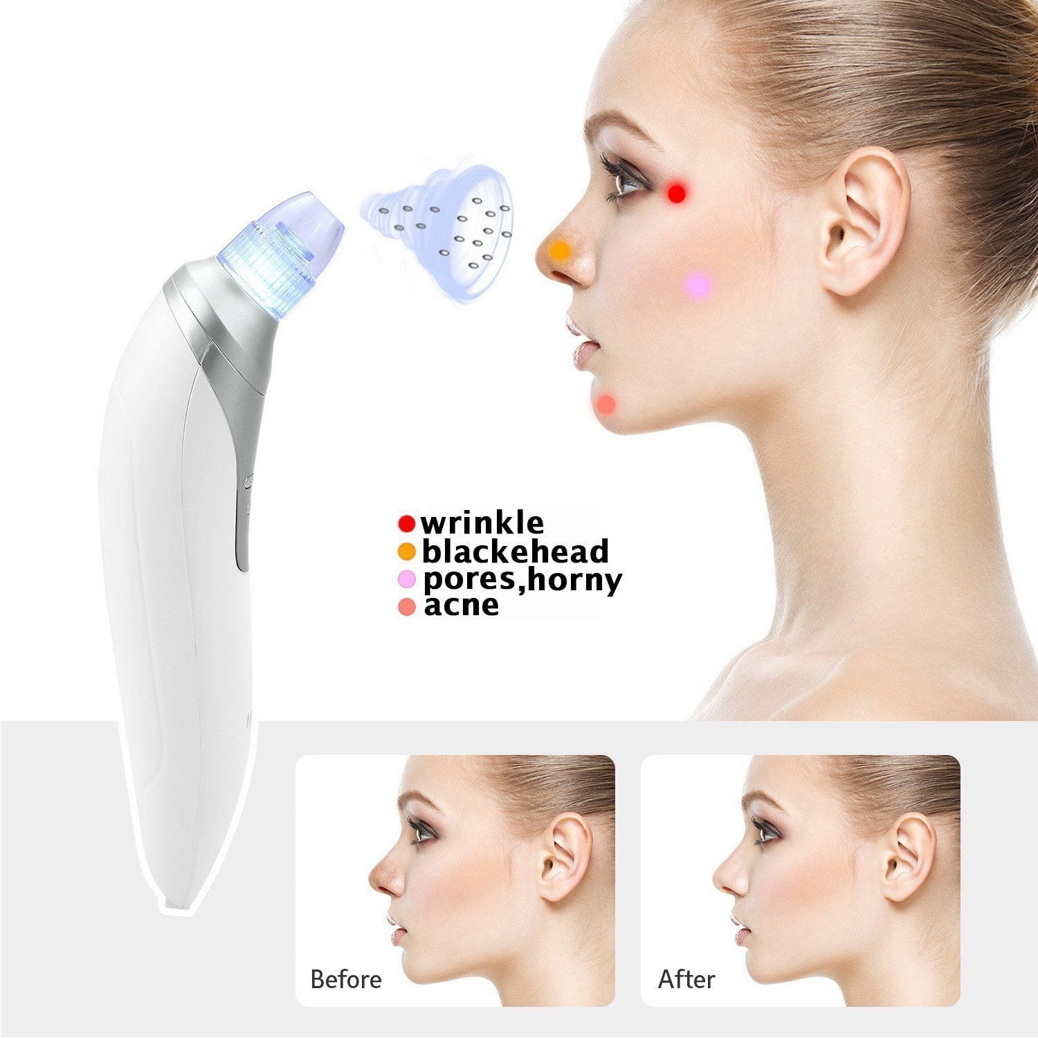 Facial Pore Blackhead Remover - Face Cleaner and Blackhead Extractor with 4 Suction Heads