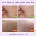 thumbnail image 5 of Spot Treatment Osmia Organics Spotless Blemish Oil, 4 ml, 5 of 5