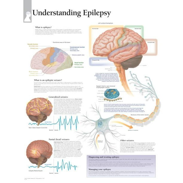 research paper about epilepsy