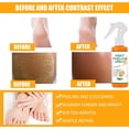 thumbnail image 4 of Spray Exfoliante para Pies Zulema 100 ml, 4 of 8