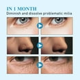 thumbnail image 2 of Redempat Milia Remover Patch Sticker Moisturize Clean Skin for Fat Granules Eye, 2 of 9