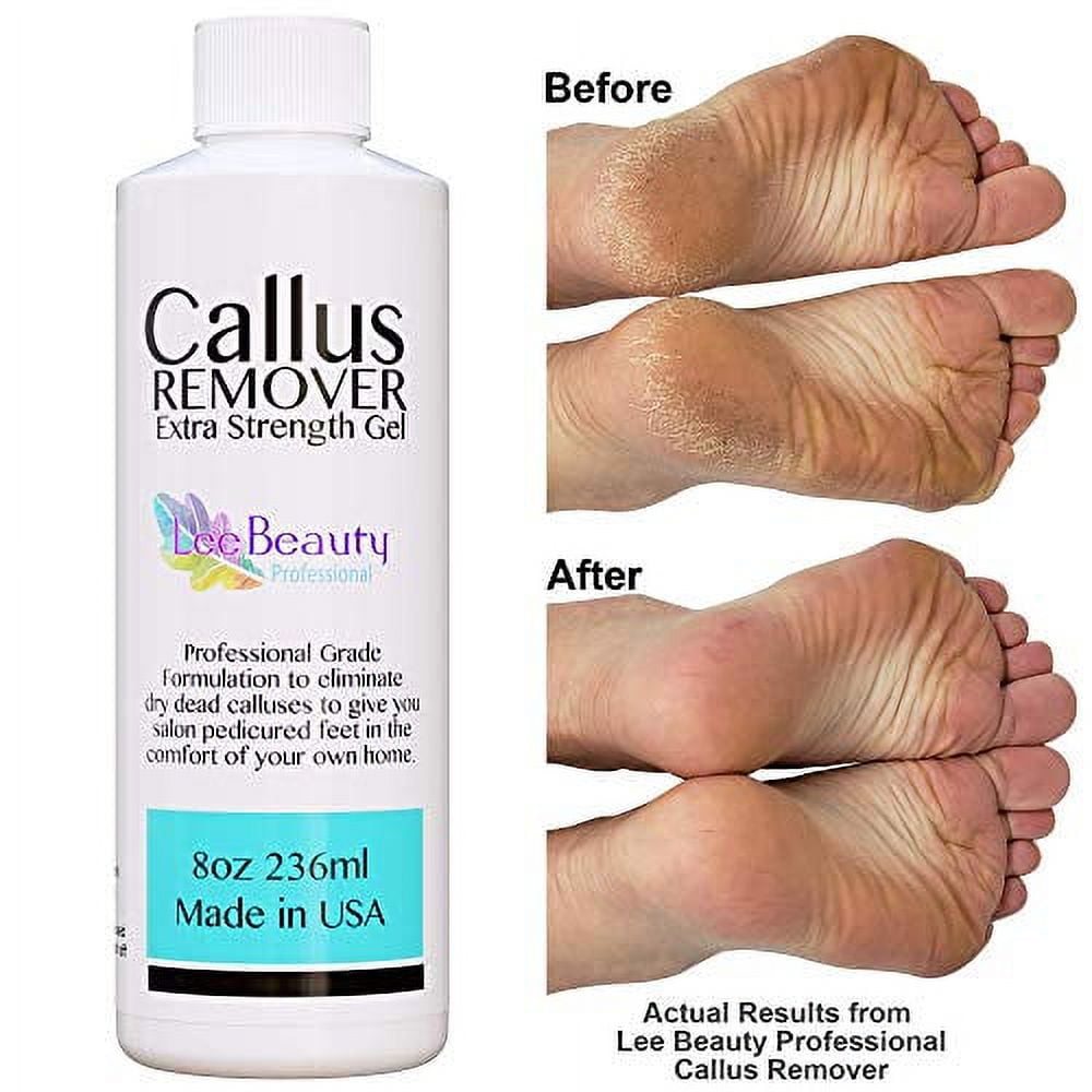 Natural Feet - Foot Callus Eliminator ( gallon ) — Angelina Nail