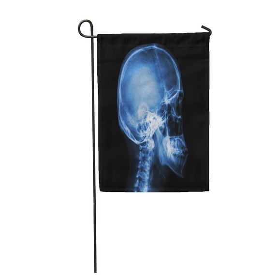 SIDONKU Blue Xray Film X Ray Skull and Cervical Spine Lateral View Brain Garden Flag Decorative Flag House Banner 12x18 inch