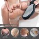 thumbnail image 5 of Lima de pies para piel muerta, removedor de callos de pies 3 en 1 con mini lima de pies, raspador de talón de fregador de pies de acero inoxidable, raspador de pedicura, pies húmedos y secos Vhermosa, 5 of 8