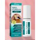 thumbnail image 4 of Para El Cuidado Las Uñas Nutritivo Eliminación Hongos en Paroniquia Manos Y Pies, 4 of 9