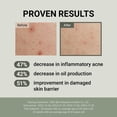 thumbnail image 3 of Crema hidratante JUMISO Snail Mucin 88 Peptide Cream 100 ml, 3 of 7