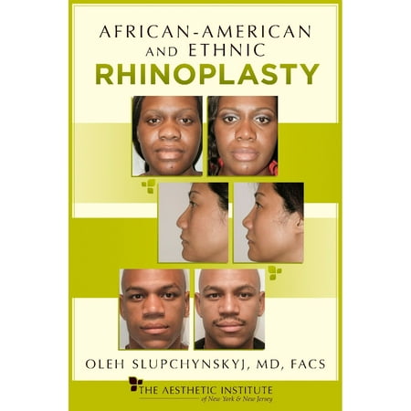 African-American and Ethnic Rhinoplasty - eBook (Best African American Rhinoplasty)