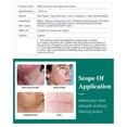 thumbnail image 1 of Scar Removal, Eye-catching Extraordinary  For Outdoor, 1 of 8