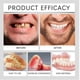 thumbnail image 3 of Full Denture Set for Men and Women Upper and Lower Denture False Teeth, 3 of 5