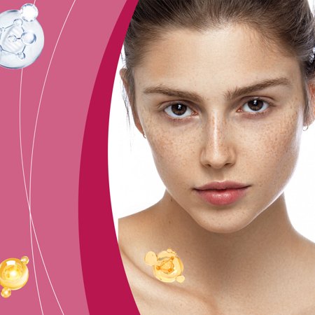 Freckle Repair Cream