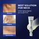 thumbnail image 3 of Sérum reafirmante para el cuello DOMINAS Atclinic con retinol y 5 péptidos, 3 of 9