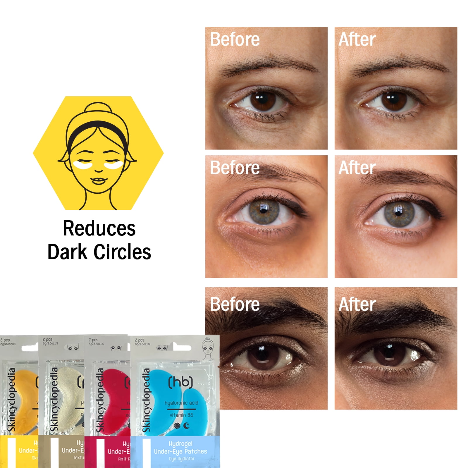 Skincyclopedia Retinol & Squalane Face Treatment, Facial Serum, Under Eye Roll-On & Hydrogel Patches, Energizing Serum for Dark Circles, Puffiness Bags, Fine Lines & Wrinkles, Firms & Brightens Skin.