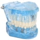 thumbnail image 2 of Modelo De Simulación De Dientes Dentales, Modelo De Dientes Livianos Para Demostración De Investigación De Patología Ccdes Otros, 2 of 8