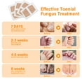 thumbnail image 5 of Toenail Fungus Treatment Extra Strength, Fungal Nail Patches, Advanced Nail Repair Strips to Restore Discolored and Damaged Nails, 32 Count, 5 of 8
