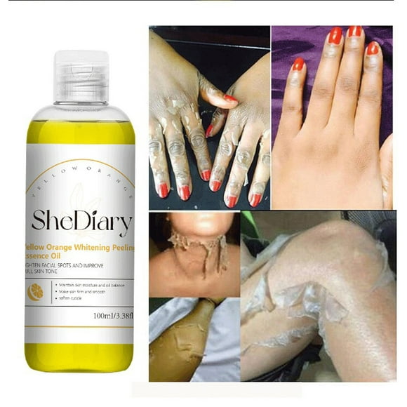 Reduced Price Naittoop Vitamin C Exfoliating Serum Locks In Hydration Tightens Pores Vitamin C Serum 100ml