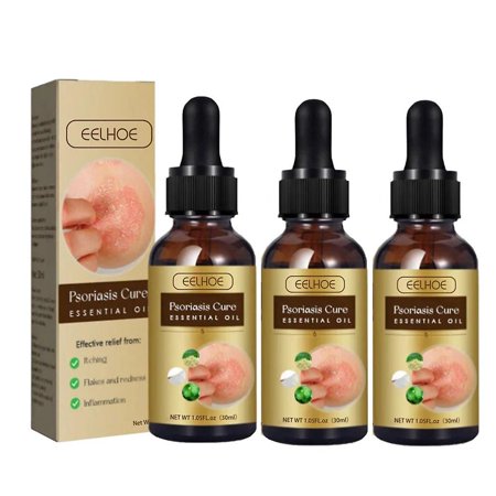 Psoriasis Essential Oil - Anti-itching Treatment for Body Skin