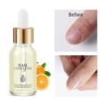 thumbnail image 1 of Aceite para uñas Nail Art, líquido nutritivo para uñas muertas y reparación de uñas apáticas, aceite suavizante para uñas, 15 ml, 1 of 3