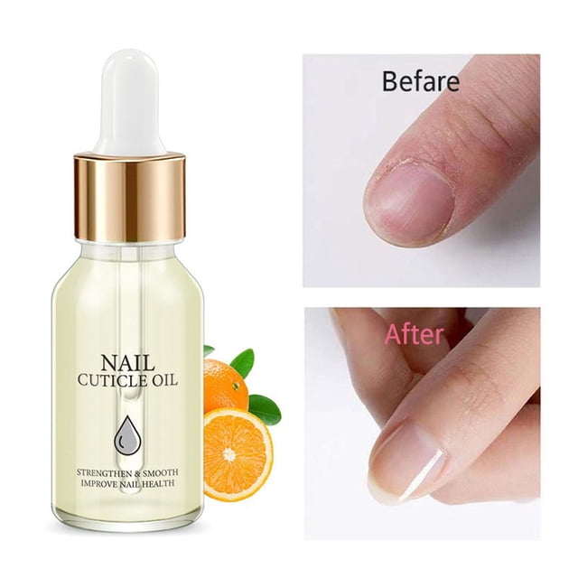 Aceite para uñas Nail Art, líquido nutritivo para uñas muertas y reparación de uñas apáticas, aceite suavizante para uñas, 15 ml