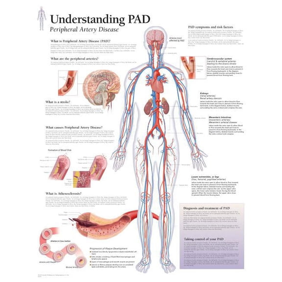 Understanding PAD chart : Laminated Wall Chart (Wallchart)