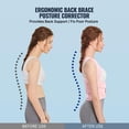thumbnail image 3 of Back Brace Posture Corrector for Women and Men, Shoulder Straightener, Adjustable Full Back Support, Upper and Lower Back Pain Relief - Scoliosis, Hunchback, Hump, Thoracic, Spine Corrector, 3 of 8
