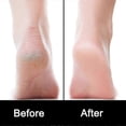 thumbnail image 5 of Foot Files, Foot File Foot Pedicure Kit, Stainless Steel Foot Files,Stainless Steel File, Foot File Foot Care Pedicure Tool for Both Wet and Dry Crack, 5 of 5