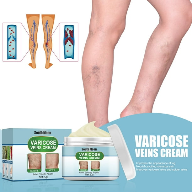 Vein Care Cream Skin Therapy Firming Lotion Eliminate The Appearance