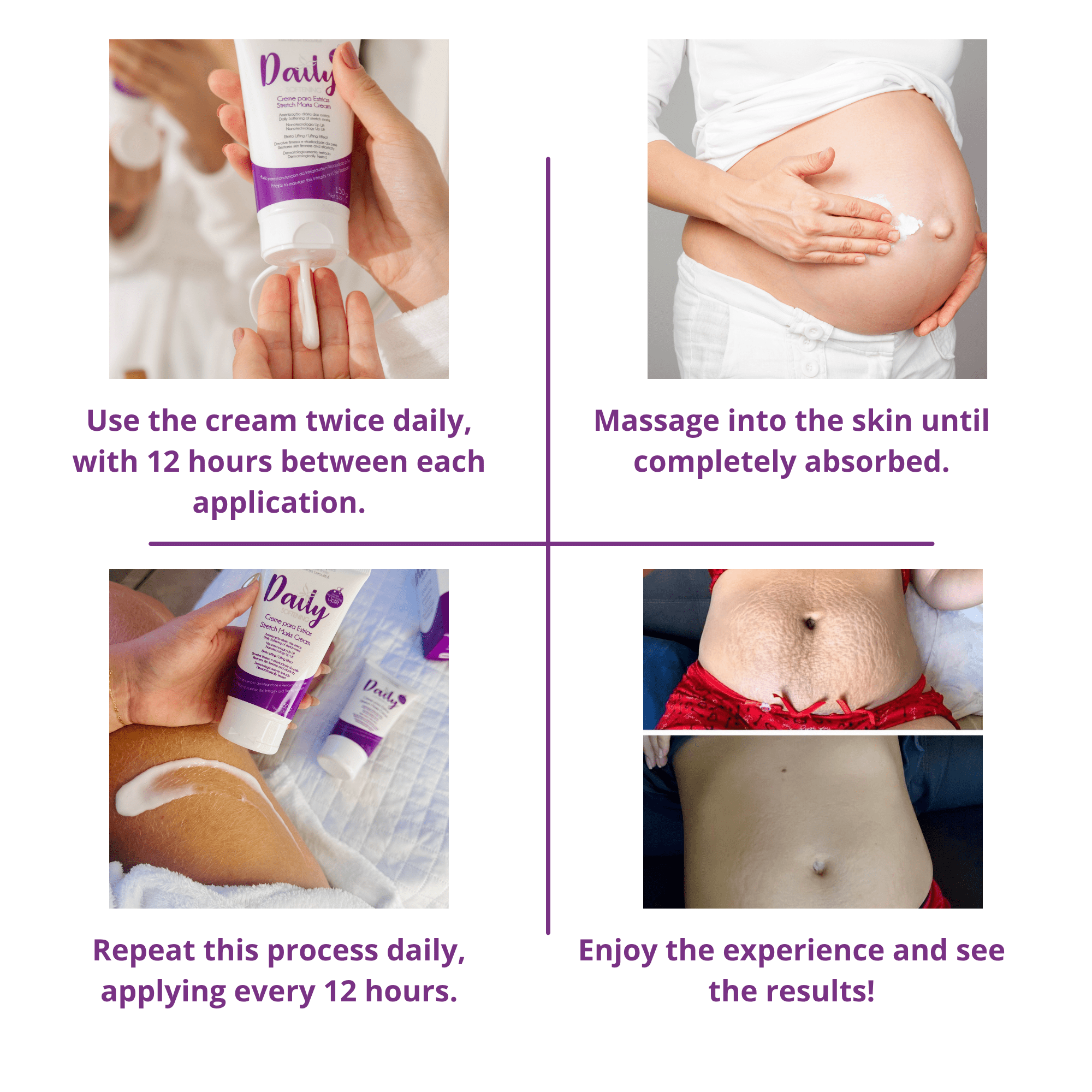 Michelle Marques Stretch Mark Cream – Pregnancy Safe, Hypoallergenic Formula with Almond Oil & Chamomile for Hydration and Elasticity (5.29 oz)