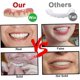 thumbnail image 4 of Teeth You Eat With Mouldable False Teeth Silica Gel Fit Perfect Teeth Stickers And Whitening Alternative Protect Your Teeth Regain Confident Smile 2 P, 4 of 5
