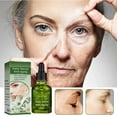 Face Texture Smoother Electronic Wart Remover Pen Korean Skin Ning Deep face-texture-smoother-electronic-wart-remover-pen-korean-skin-ning-deep