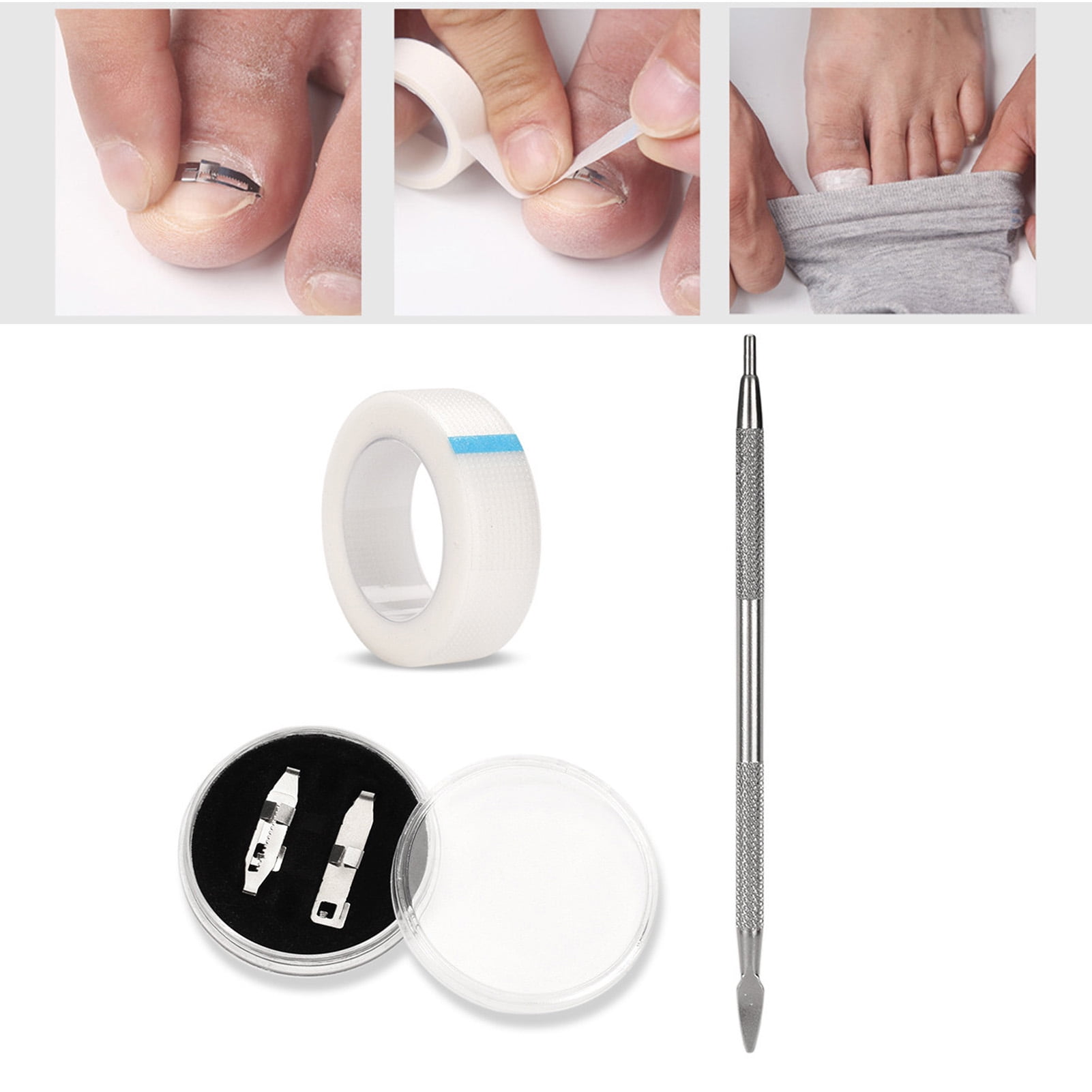 Travelwant Professional Ingrown Toenail Correction Treatment Kit,Ingrown Toenail Corrector
