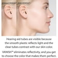 thumbnail image 5 of Make Your Hearing Aids VANISH - Light, 5 of 8