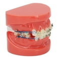 thumbnail image 1 of Alambres De Metal Modelo Dental, Modelo Dental Alambres De Metal 24 Dientes Medio Metal Medio Soporte De Cerámica Diente Modelo Correcto Para La Enseñanza Del Estudio, 1 of 5