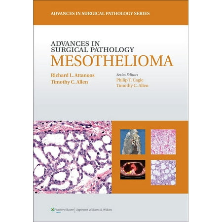 UPC: 9781608316182 | Advances in Surgical Pathology: Mesothelioma