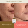 thumbnail image 3 of Sérum para manchas oscuras EADEM Milk Marvel con vitamina C 30 ml, 3 of 7