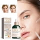thumbnail image 1 of Suero rellenador rápido de péptido de escualano y cobre, líquido de esencia de concentración rápida de péptido de cobre de escualeno, líquido de esencia facial hidratante 50 ml, 1 of 6