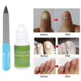 thumbnail image 4 of justharion 10ml Nail Fungus Liquid Set Nail Fluid Cotton Stick and File Set, 4 of 7