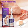 thumbnail image 2 of 2pcs Corn Removal Extra Strengthen Gel Foot Callus Removal Treatment Hard Skin, 2 of 5