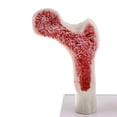 thumbnail image 3 of 1:1 Human Lumbar Vertebra Thighbone Osteoporosis Pathology Model Kit, 3 of 9
