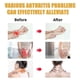 thumbnail image 2 of Bee-Venom Joint Pain Relief Cream, Soothing Massage Gel for Hands, Feet, Lumbar Spine, Pain Relief for Men & Women, 2 of 5