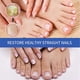 thumbnail image 4 of Nail Repair Essences Multipurpose Onychomycosis Care Solution Nail Care Supplies, 4 of 5
