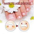 thumbnail image 4 of Jaysuing anti-nail groove relief oil, soft nail polish, repair ingrown toenails, thickened onychomycosis, nail groove care oil Cuticle Cream & Oil1PCS, 4 of 5