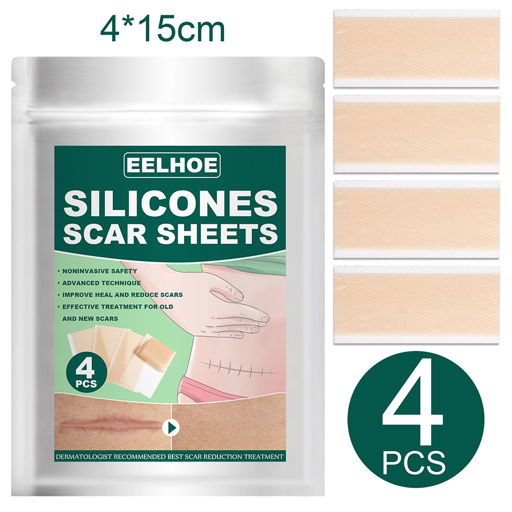 Akerlok 4pcs Silicone Gel Scar Sheet for Trauma Injury Reduce Therapy