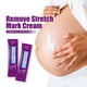 thumbnail image 4 of Crema Para Estrías, Crema Profesional Para Reparación De Estrías, Extracto De Planta Hidratante, Seguro, Portátil Para El Hogar Para Mujeres, 4 of 7