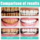thumbnail image 3 of 3pcs Coconut Oil Pulling With Tongue Scraper, Whitening Pulling Oil Mouthwash, Peppermint Essential Oil For Fresh Breath, Teeth Whitening, 3 of 5