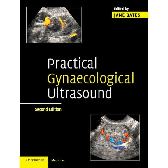Practical Gynaecological Ultrasound, (Paperback)