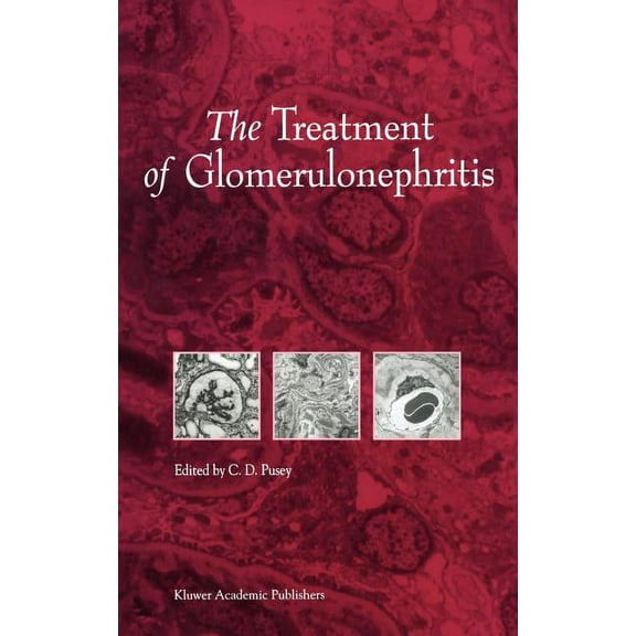 Developments in Nephrology The Treatment of Glomerulonephritis, Book 40, (Hardcover)
