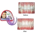 thumbnail image 2 of Children Dental Tooth Orthodontic Retainers Appliance Trainer Kids Alignment, 2 of 5